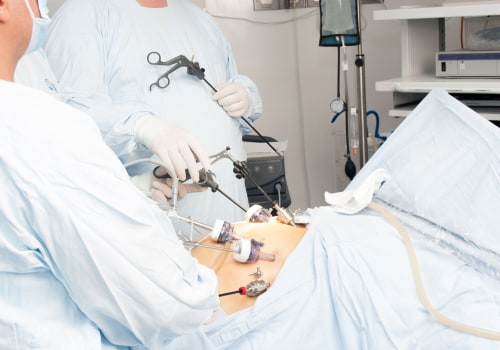 How Long Does a Full Gastric Bypass Surgery Take?