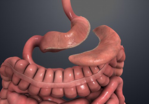 What are the Most Serious Complications of Gastric Bypass Surgery?